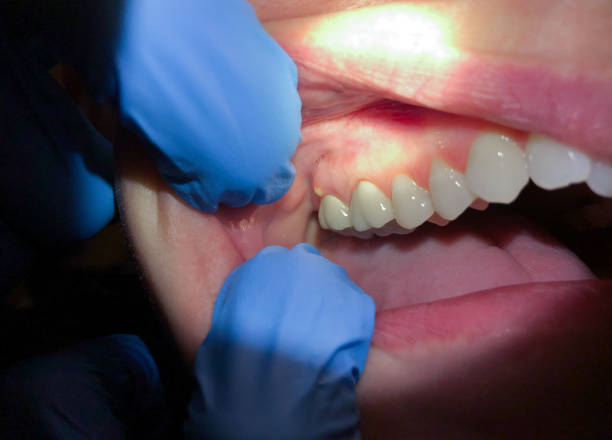 Best Mobile Emergency Dentist in Norwood, NC