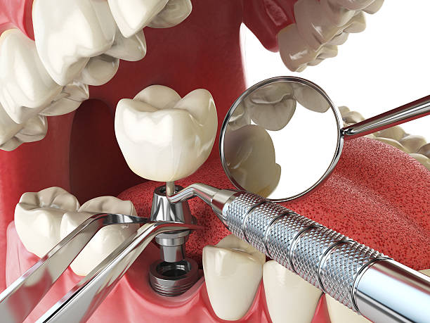 Best Orthodontic Emergency Dentist in Norwood, NC